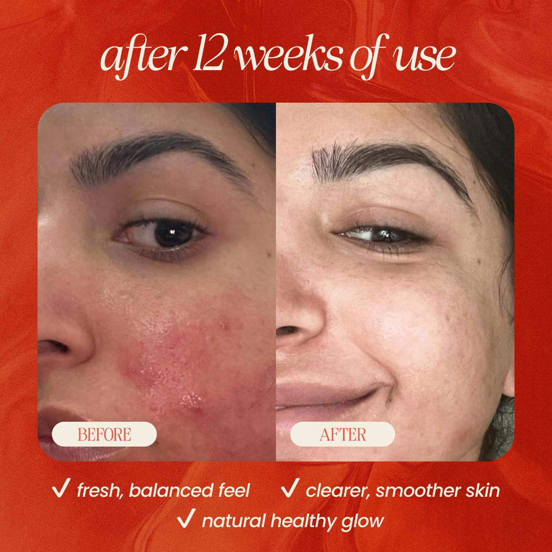 Peach & Basil Balancing Face Cleanser - BIG FRENCHIES