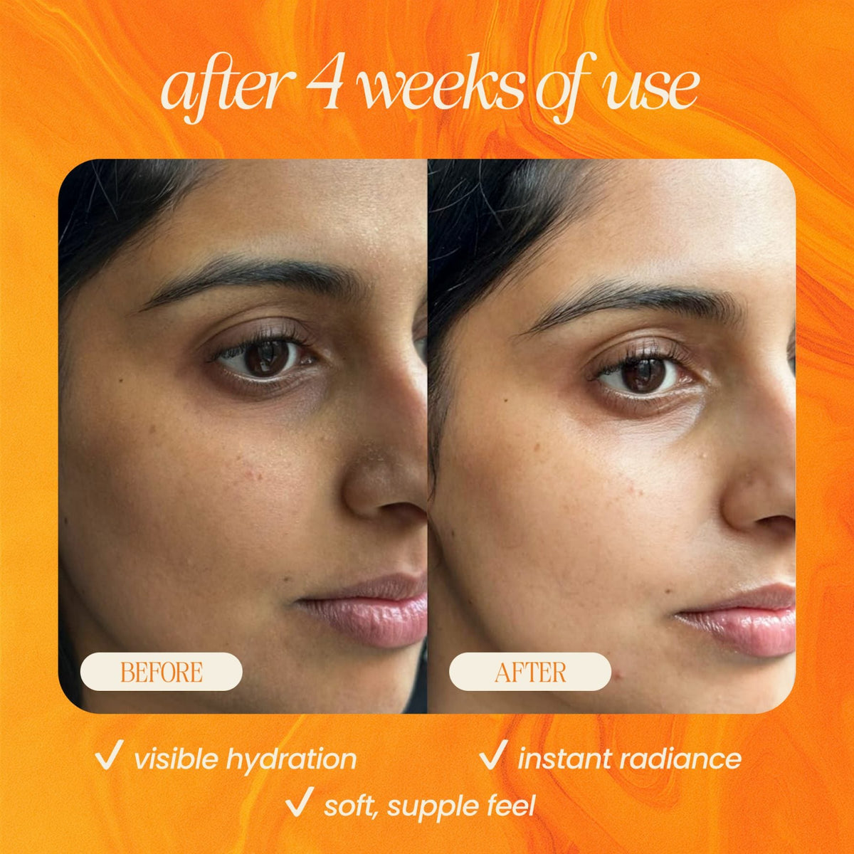 Bakuchiol Skin Renewing Facial Oil (Retinol Alternative) - BIG FRENCHIES