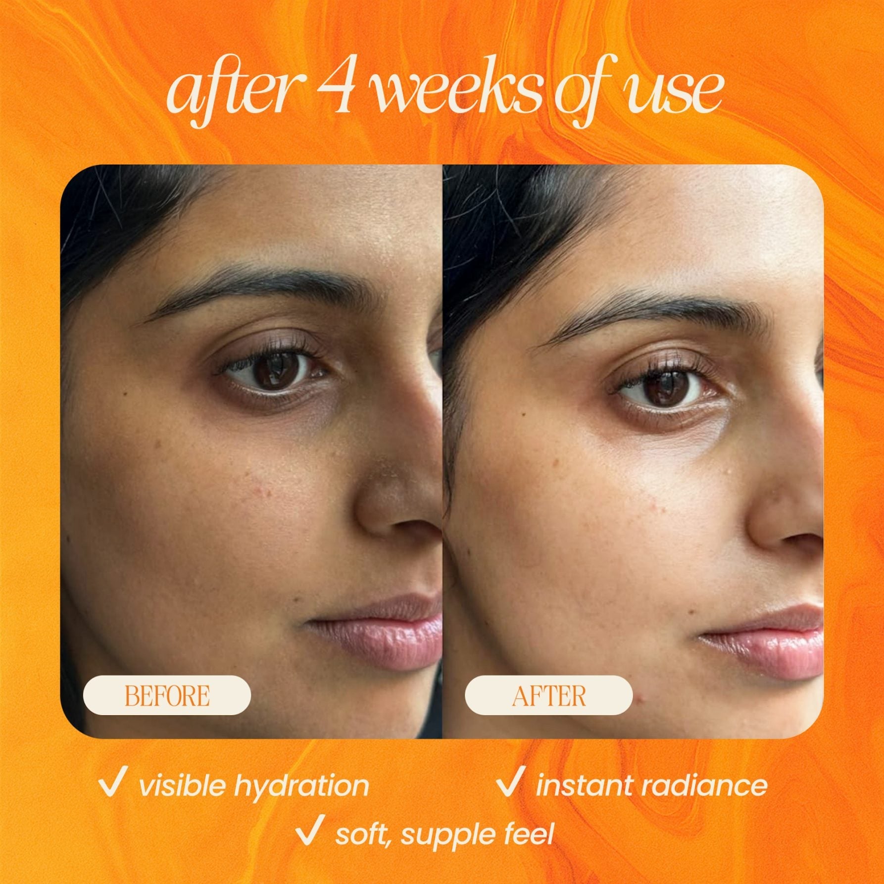Bakuchiol Skin Renewing Facial Oil (Retinol Alternative) - BIG FRENCHIES