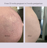Revitalize Postpartum Cream Refill Pouch