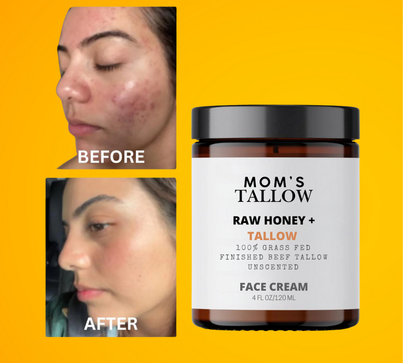 Skin Serenity Face Cream – Nourishing Balm for Sensitive & Flaky Skin - BIG FRENCHIES