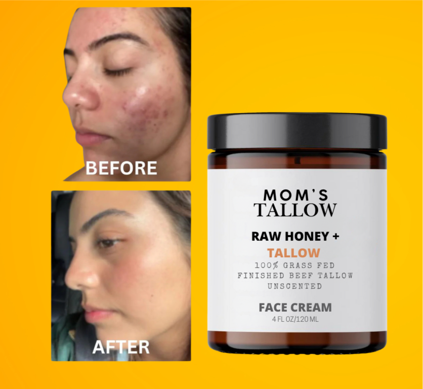Skin Serenity Face Cream – Nourishing Balm for Sensitive & Flaky Skin - BIG FRENCHIES