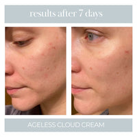 Ageless Cloud Cream - BIG FRENCHIES