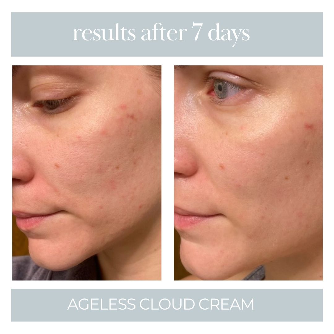 Ageless Cloud Cream - BIG FRENCHIES