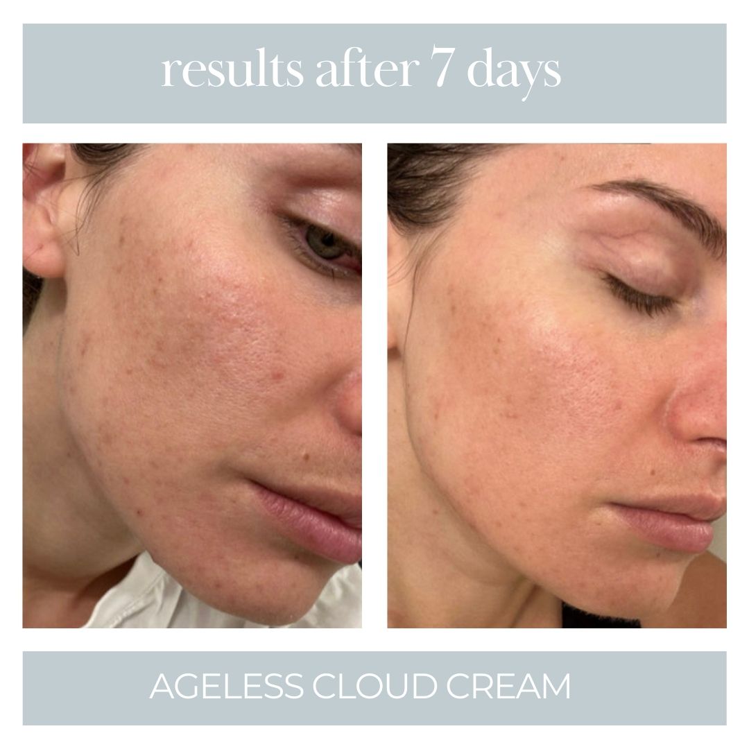 Ageless Cloud Cream - BIG FRENCHIES