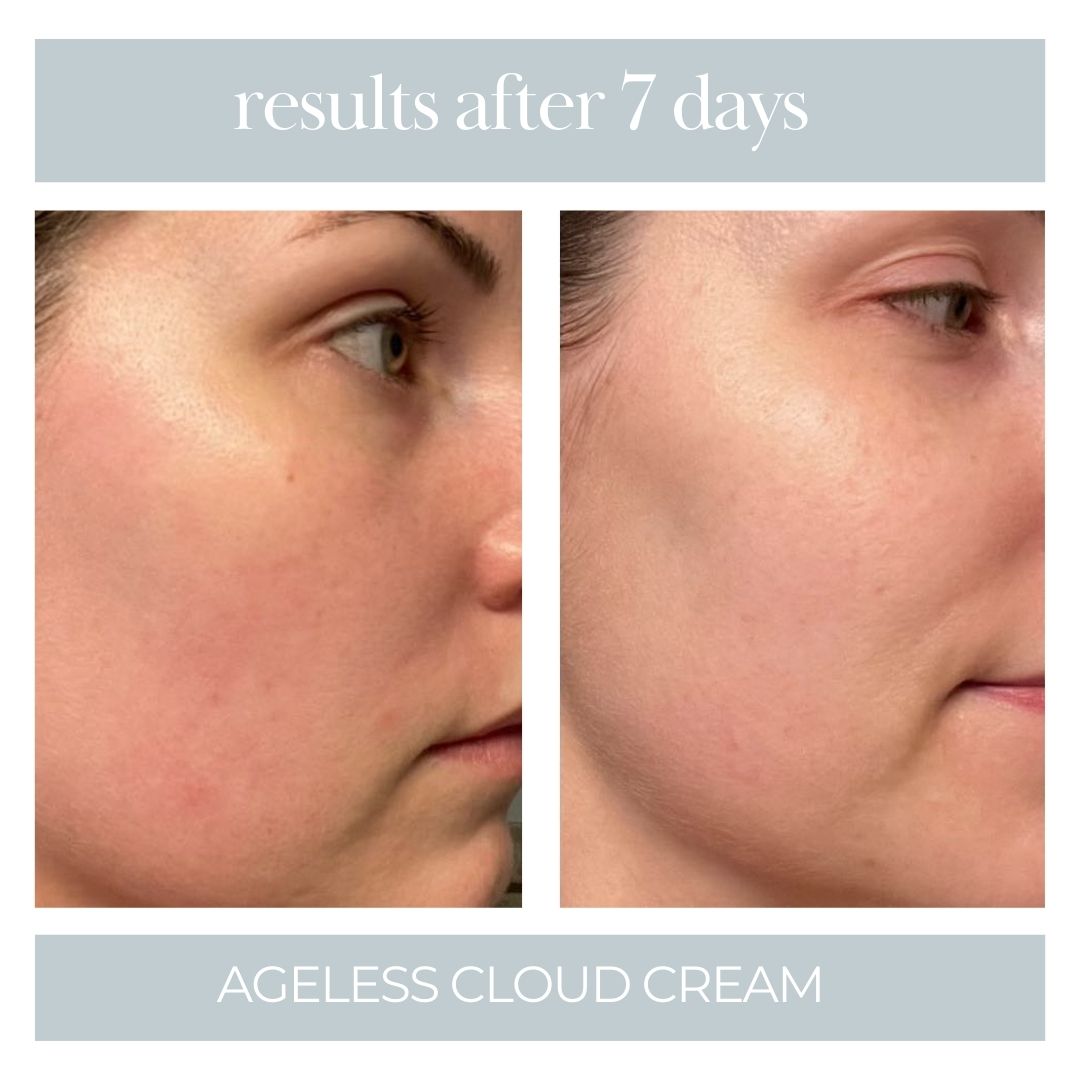 Ageless Cloud Cream - BIG FRENCHIES