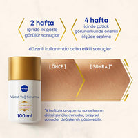 NIVEA Luminous Stretch Mark Serum - Body Moisturizer for Stretch Marks with LUMINOUS630, Long-Lasting Hydration & Anti-Stretch Mark Body Oil