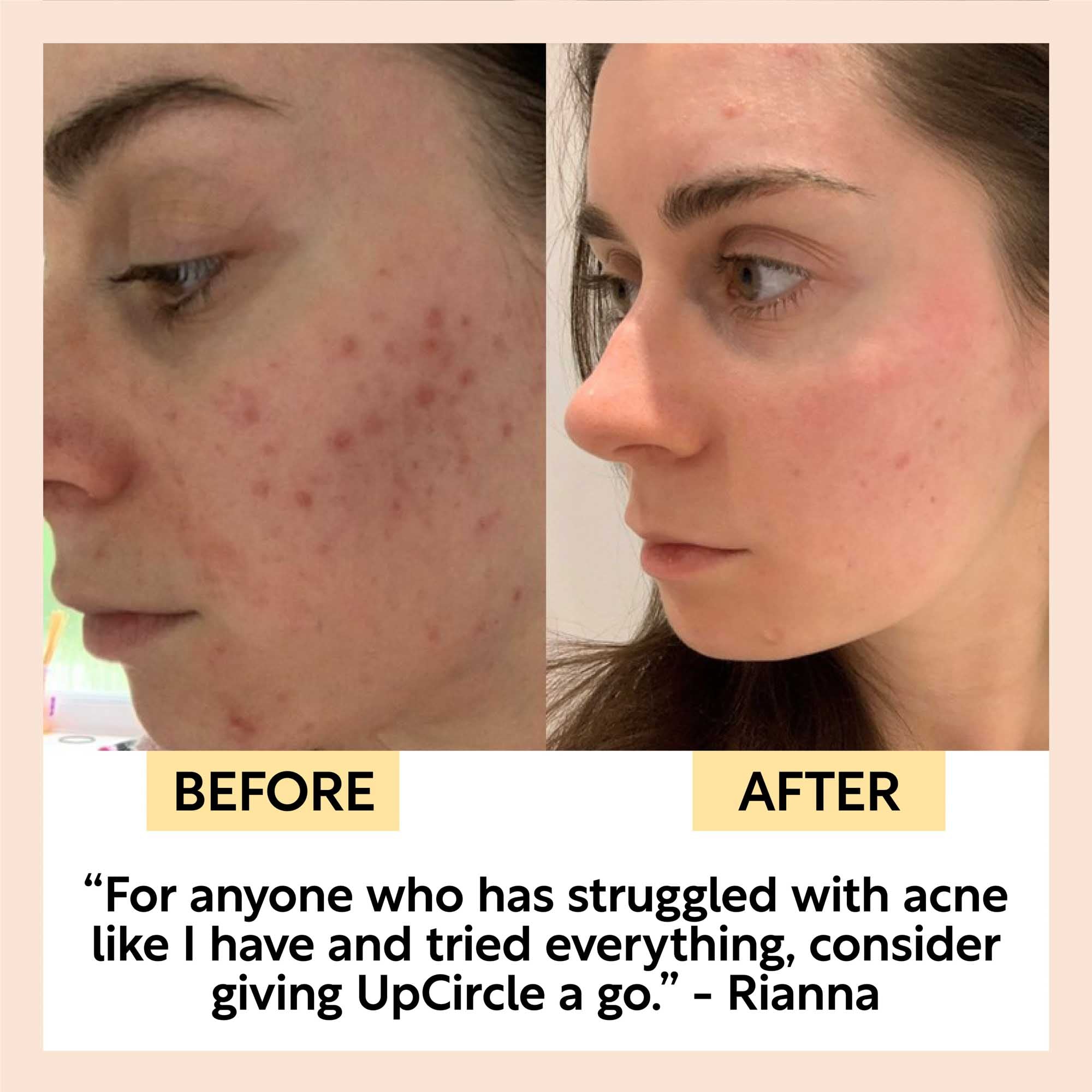 Cleanse, Tone + Moisturize Set