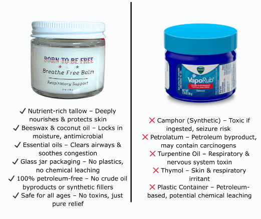 Breathe Free Respiratory Balm - BIG FRENCHIES