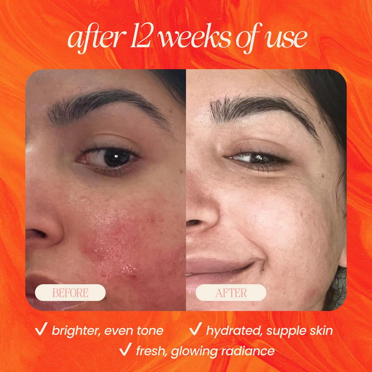 Pineapple & Rosehip Vitamin C Serum - BIG FRENCHIES