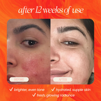 Pineapple & Rosehip Vitamin C Serum - BIG FRENCHIES
