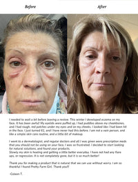 Pure + Simple Skin Kit for Sensitive Skin - BIG FRENCHIES