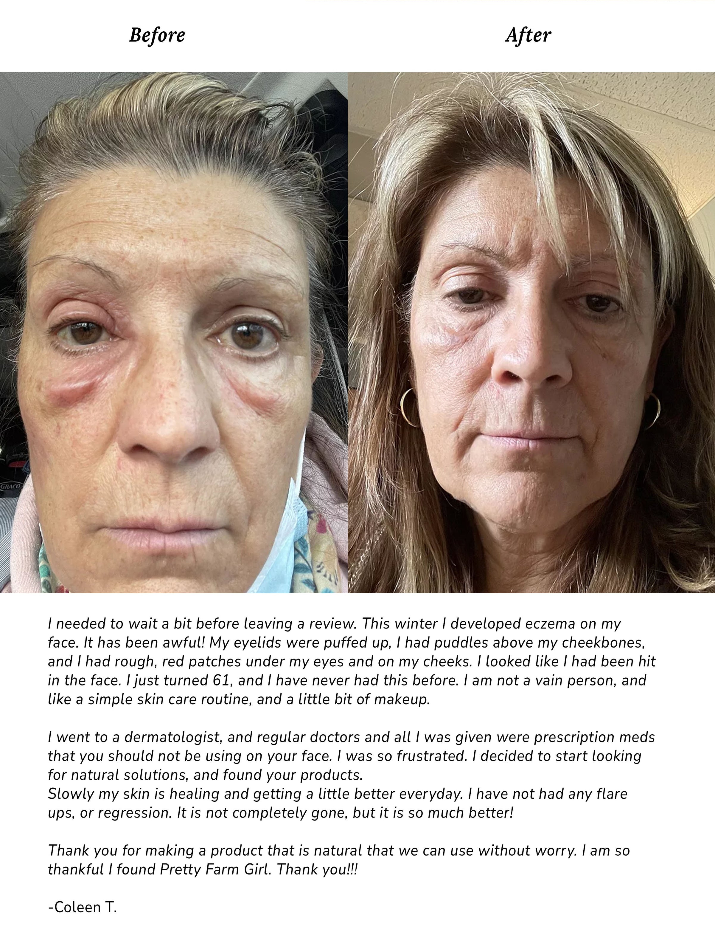 Pure + Simple Skin Kit for Sensitive Skin - BIG FRENCHIES