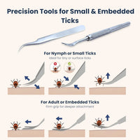 Tick Remover Kit Hooks Comb Stainless Steel Tool Dogs Cats Travel First Aid