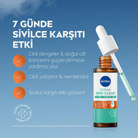 Nivea Acne Control Facial Serum - Balances Oily Skin, Reduces Acne - 1.01 fl oz